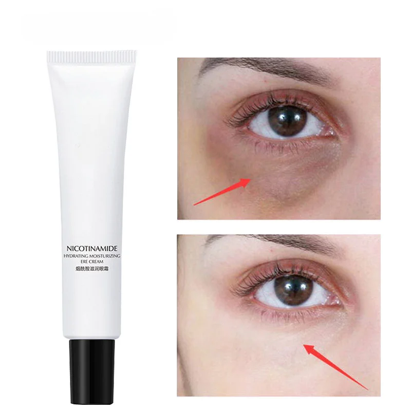 

Nicotinamide Eyes Cream Whitening Dark Circles Remove Eye Bags Under Eye Hyaluronic Acid Moisturizing Serum Against Puffiness