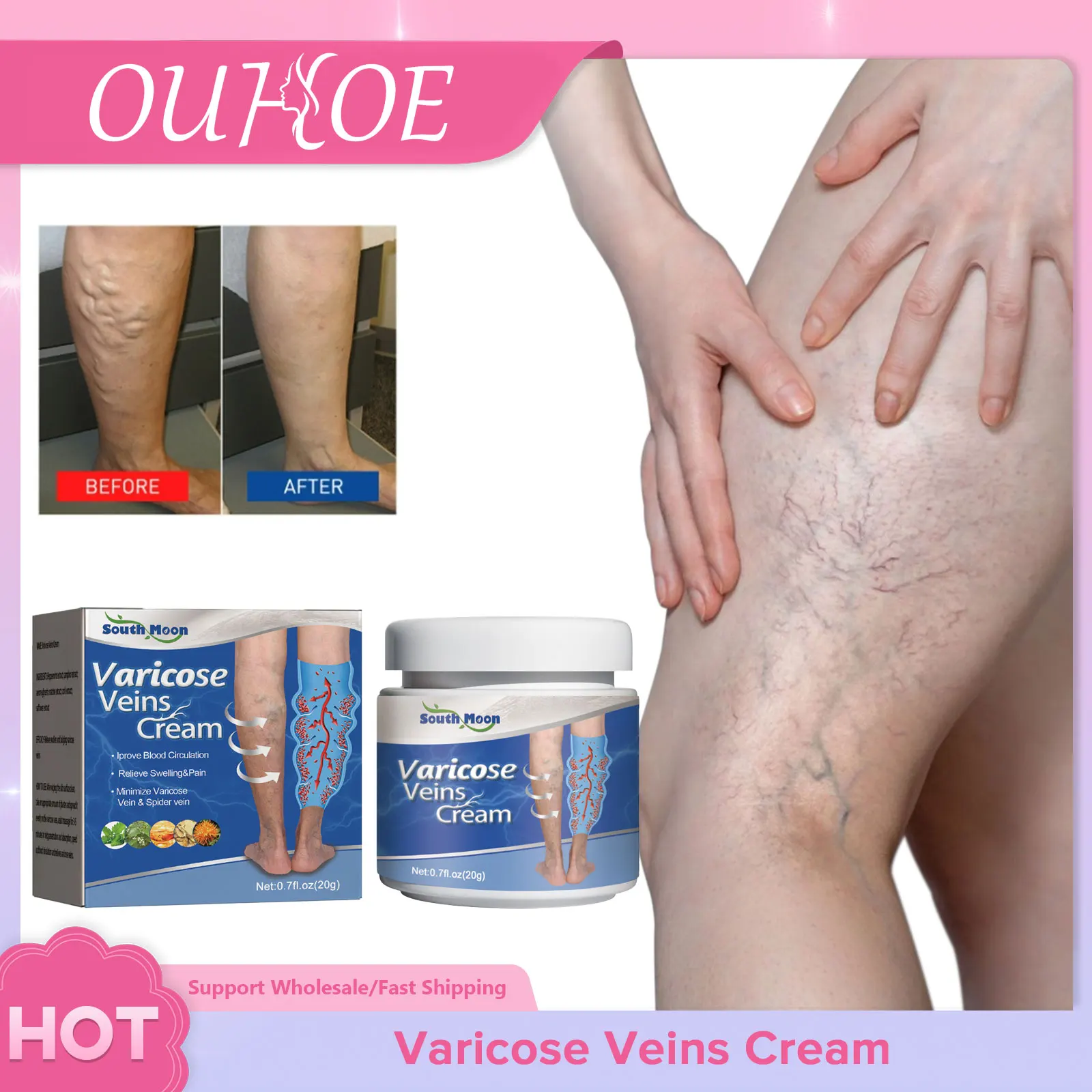 

Varicose Veins Relief Cream Relieve Vasculitis Phlebitis Spider Legs Treatment Soothing Anti Swelling Angiitis Removal Ointment