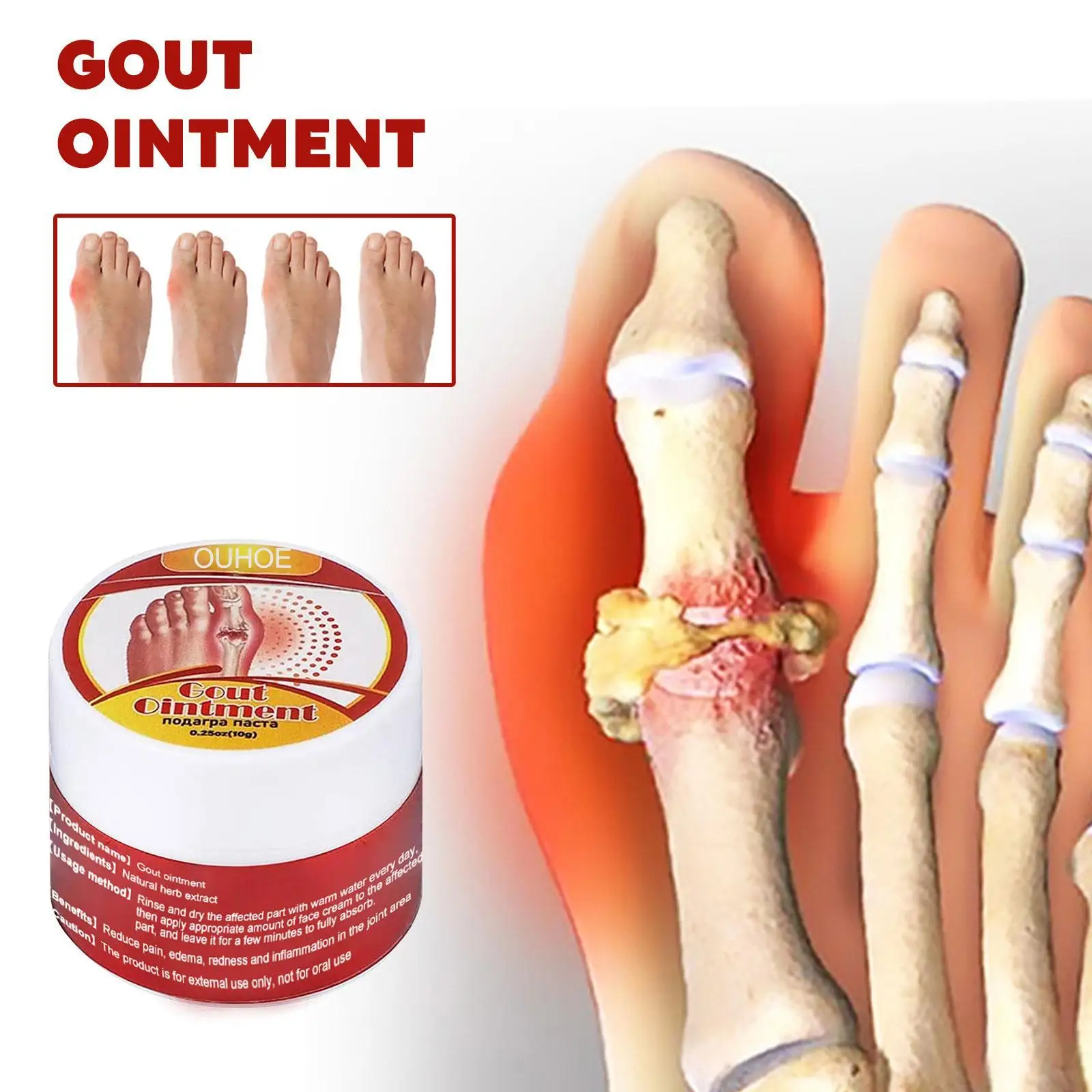 

Крем для лечения артрита, деформации коленного сустава и поясницы