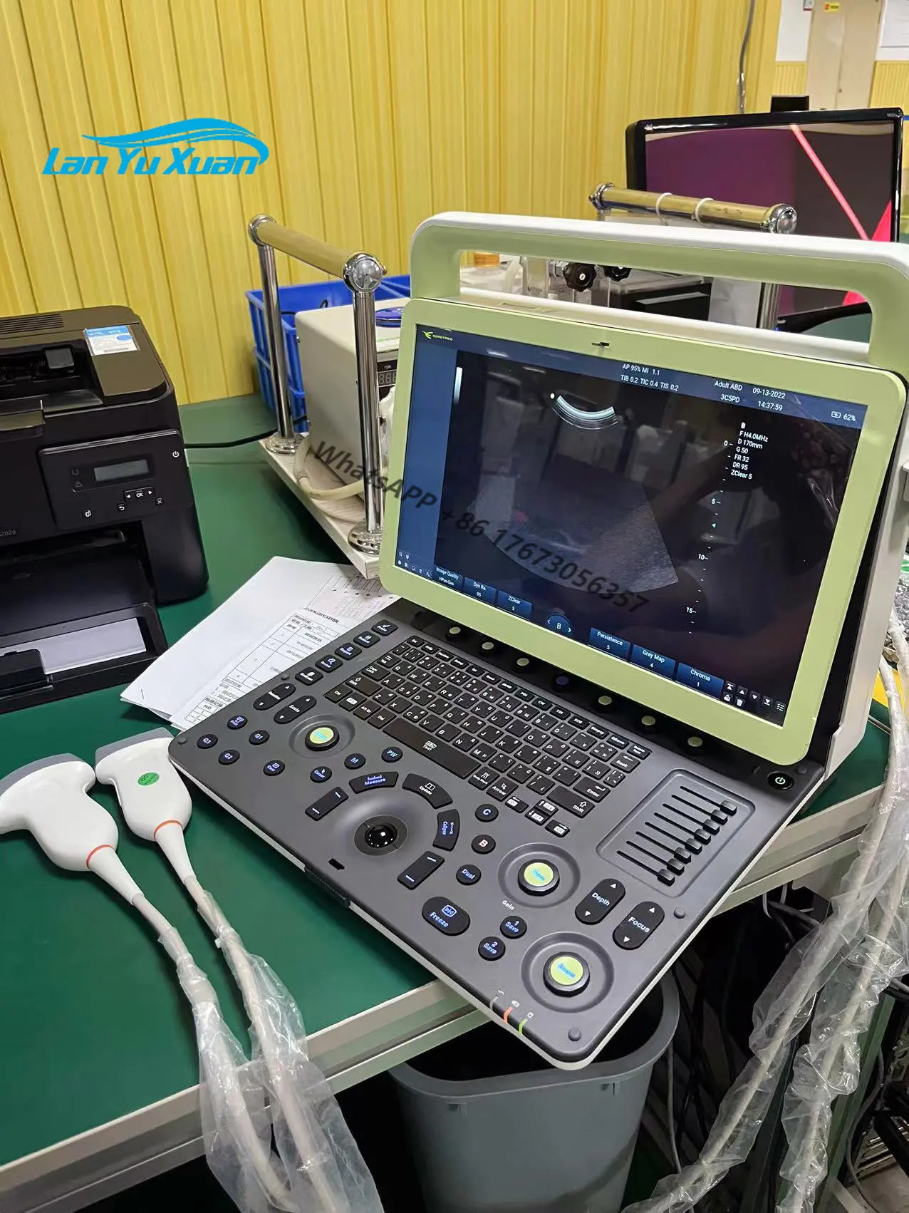 

The cheapest intelligent portable ultrasound machine in hospitals for diagnosing ultrasound systems