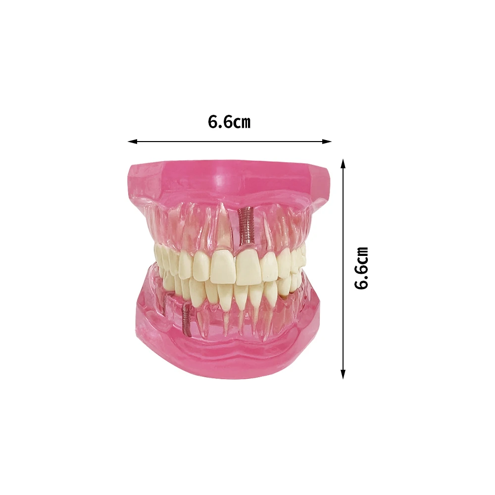 Модели зубов ремонтные модели из смолы для изучения и исследования медицины