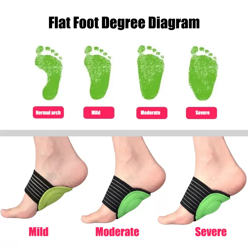 Orthopedic Insoles for Flat Feet Arch Support Orthotic Shoe Insoles for Men Plantar Fasciitis Relief Therapy Flatfoot Corrector