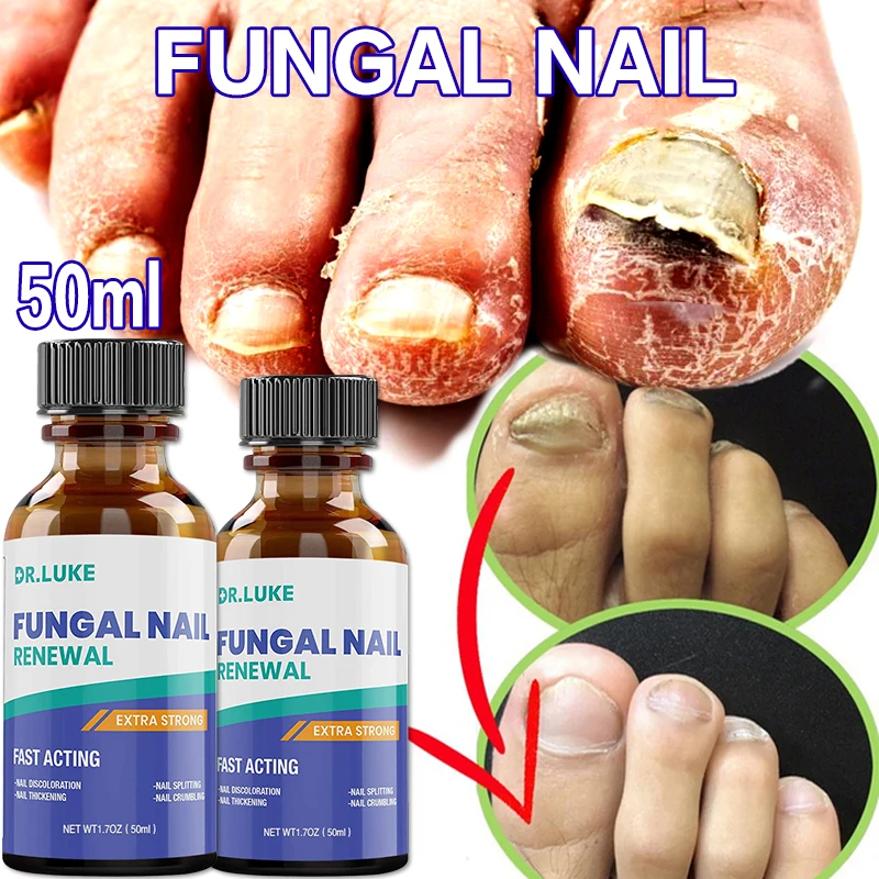 

50ml Nail Repair Essence Serum Anti Fungal Nail Treatment Remove Onychomycosis Nourishing Brighten Hand Foot Toes Nail Care