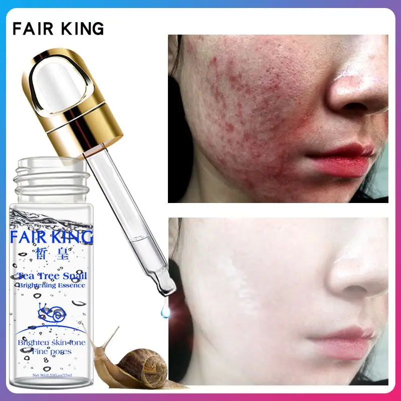 

15ml Snail Hyaluronic Acid Serum Moisturizing Whitening Lifting Firming Anti-Aging Face Skin Care Easily Absorbed TSLM2
