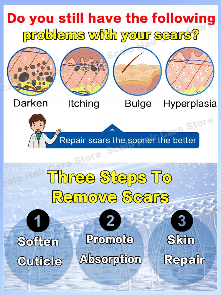 Creme de Remoção Cicatrizes Cesariana Estrias cirúrgicas Queimar Escalda Graves