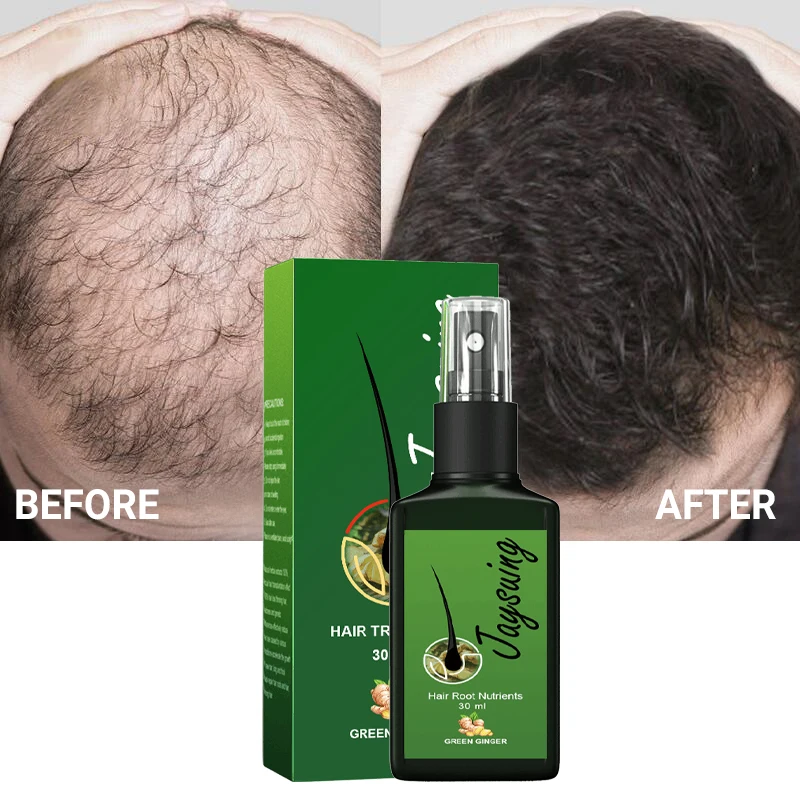 

Ginger Hair Growth Spray Fast Grow Anti Hair Loss Natural Scalp Treatment Essence Repair Nourish Damaged Hair Root Beauty Health