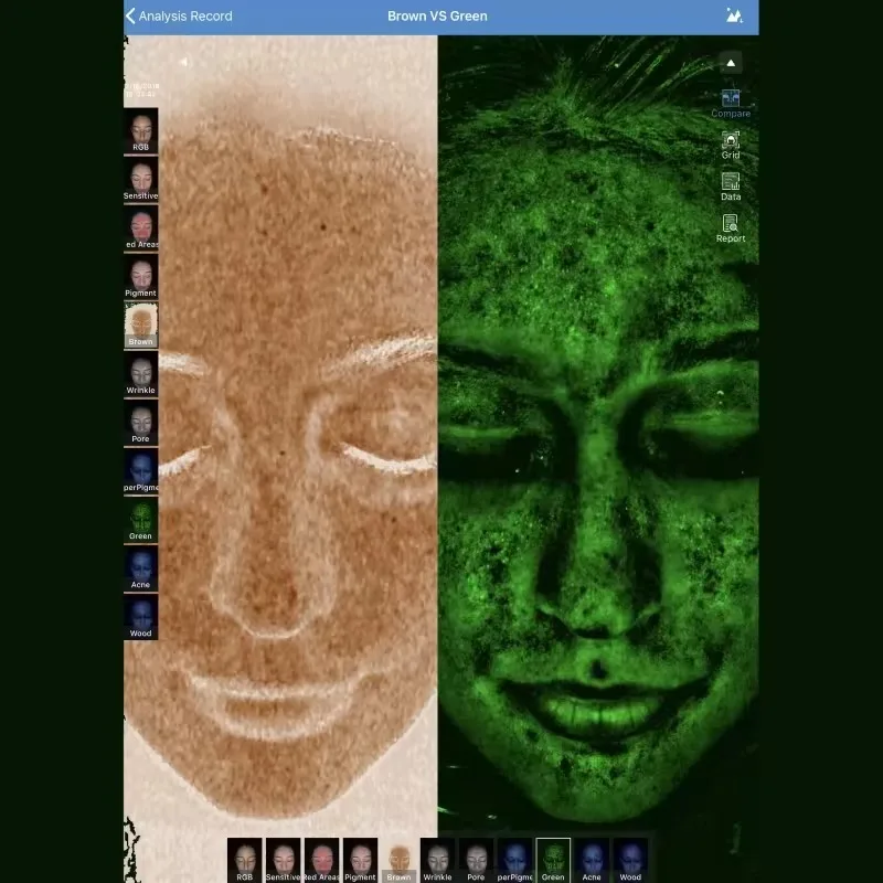 Meicet Многофункциональный 3D косметологический сканер изображений кожи анализатор