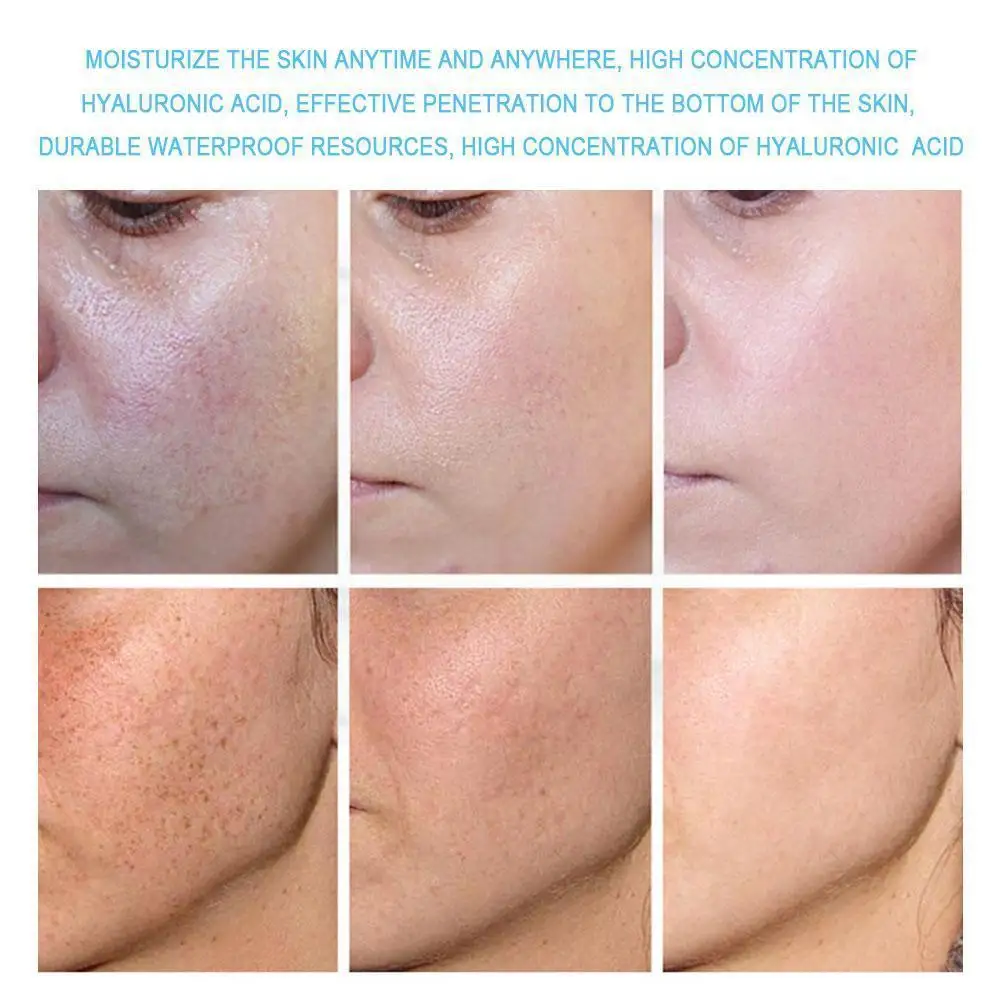 

Effective Whitening Freckle Cream Remove Melasma Acne Complexion Brightening Moisturizing Cream Cosmetics Beauty Spot Skin C6n4