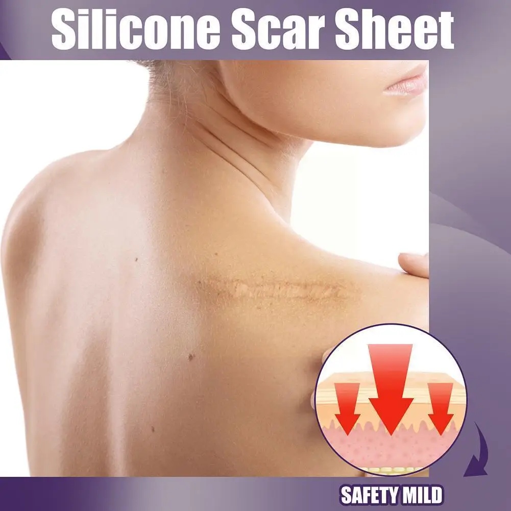 

Skin Color Scar Sticker Reusable Silicone Scars Removal Repair Surgery Strip Gel Flat Self Repair Patch Sheet Adhesive Skin S7J0