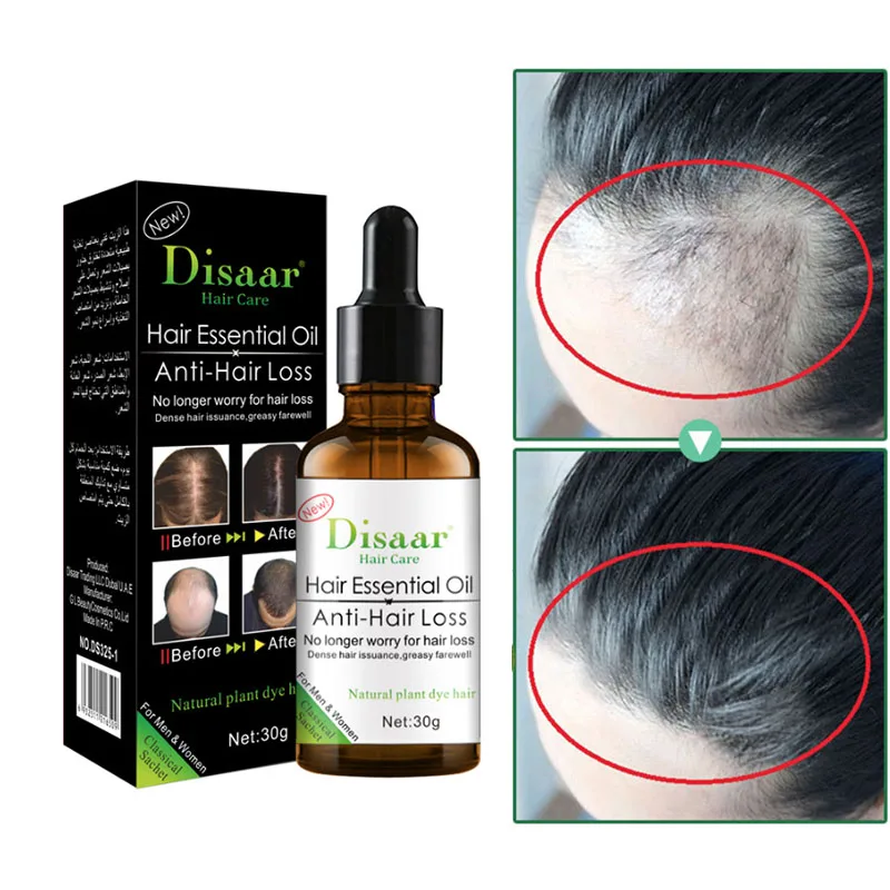 

Hair Growth Essentials Oil Serum Anti Frizz Rapide Pousse Des Cheveux Treatment Crescer Cabelo Vitaminas Para El Cabello Hombre