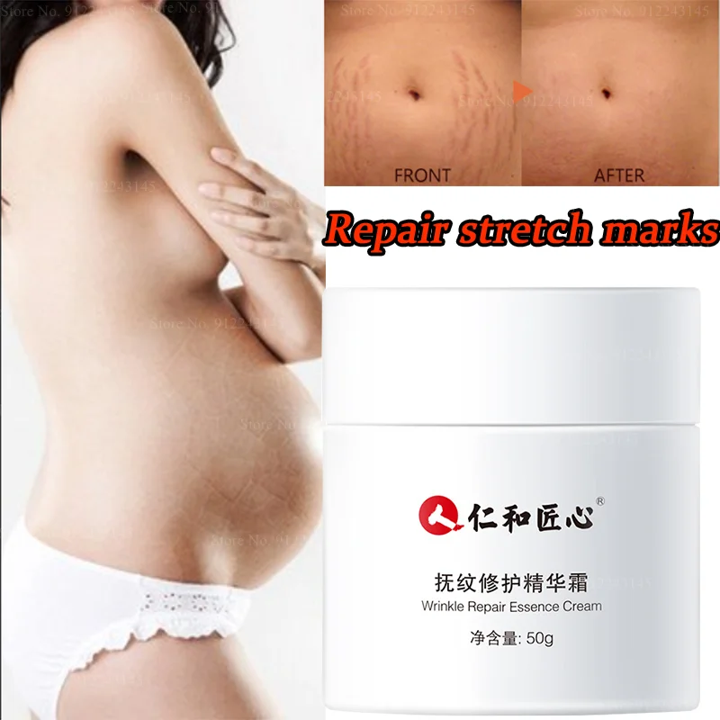 

Pregnant Women's Tightening Repair Cream Pregnancy Postpartum Growth Cream Fat Lines and Stretch Marks Pregnancy Repair Cream