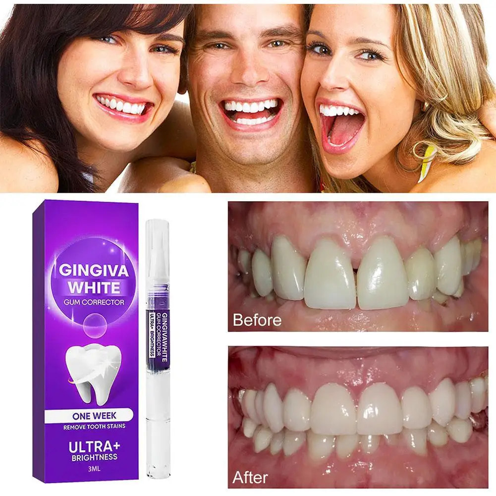 

Teeth Yellowing Pen Whitening Brightening Cleaning Yellowing Fresh Breath Against Dental Caries Plaque Stain Removal Essence 3ml