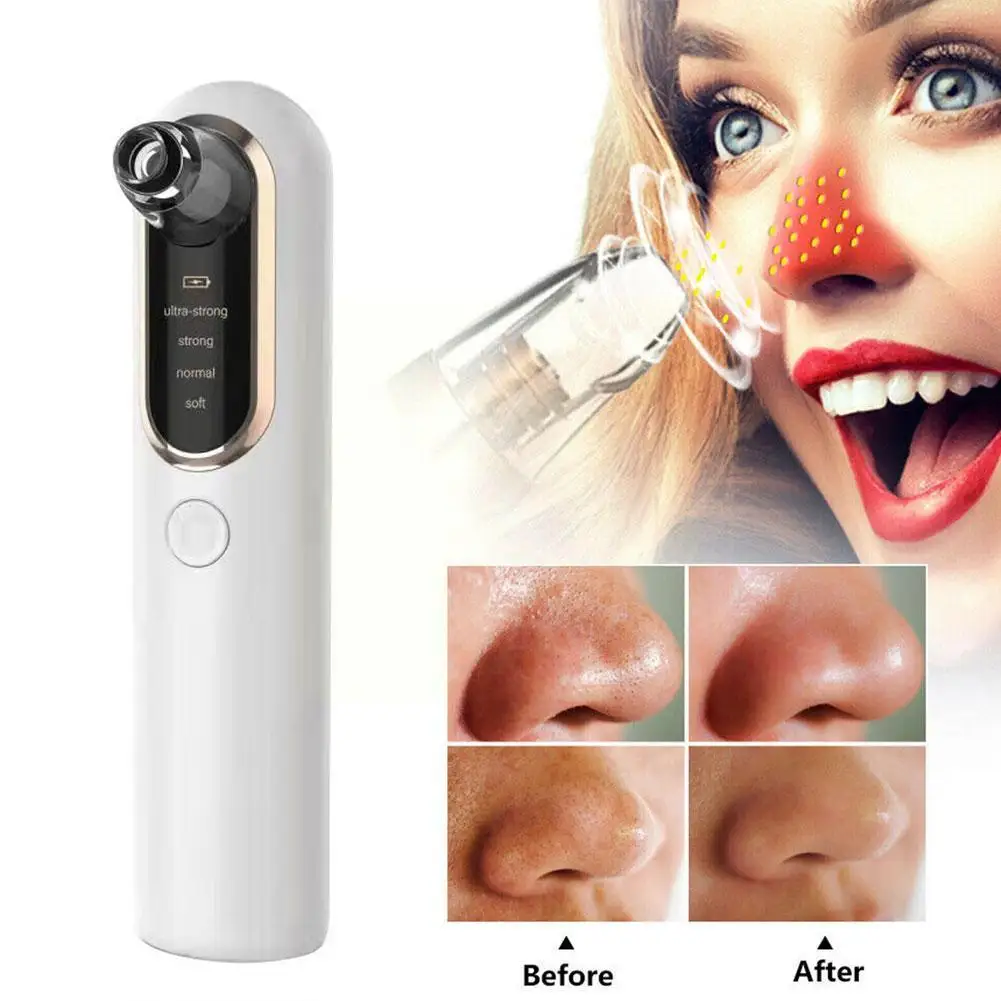 

Electric Blackhead Remover Acne Face Cleaner Vacuum Suction Pimple Acne Facial Black Pore Tool Extractor Remover Head Clean V5I5