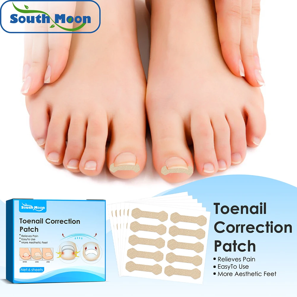 

Nail Correction Stickers Ingrown Toenail Nail Treatment Pedicure Tools for Paronychia Inner Roll Armor Recovery 60pcs/Box