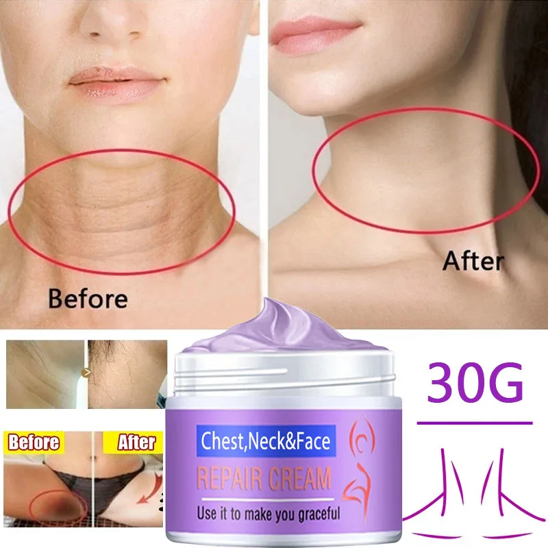 

2022 New Private Parts Anti Wrinkle Essence Whitening Firming Cream Anti Aging Cream for Chest Neck and Face Care Products
