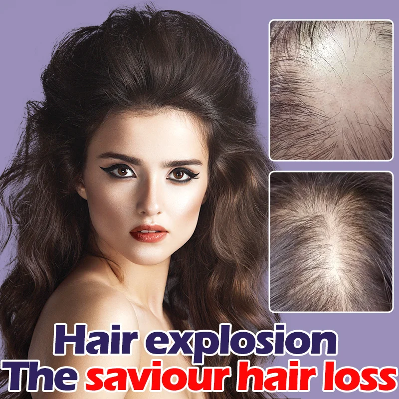 

Масло для быстрого роста волос, лечение волосяного фолликула, восстановление шелухи и облысения после родов, для мужчин и женщин