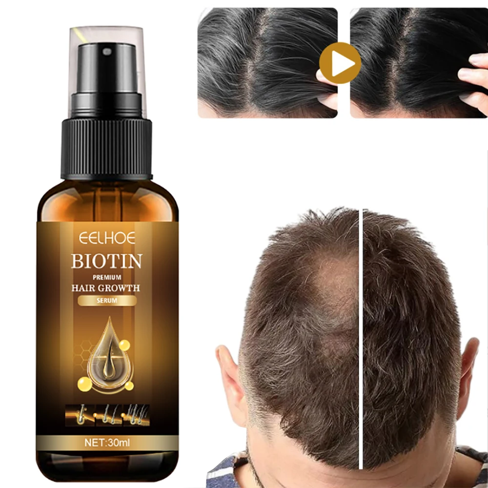 

Biotin For Regrowth Hair Growth Serum Oils Sprays Biotina Vaporisateur Pousse De Cheveux Rapide Pray Para Crecimiento Cabello