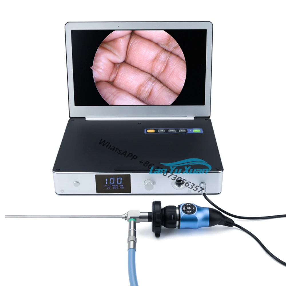 

Portable All In One Medical Endoscopy System Full HD with 11.6 Inch and 30W LED Light Source