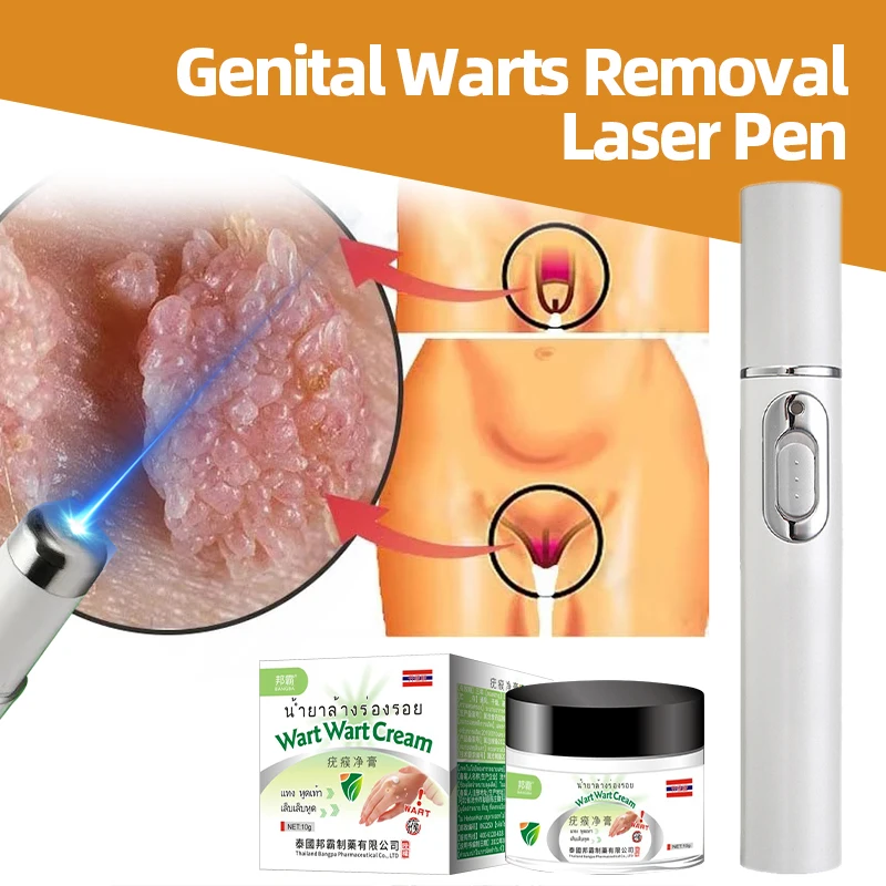 Лазерная ручка для удаления генитальных бородавок мужчин и женщин лечение