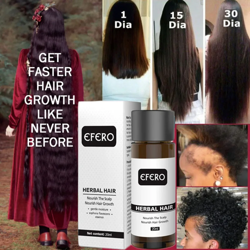 

Ginger Hair Growth Oil Hair Regrowth Serum Hair Thinning Treatment Anti Lost Beauty Products Fast Grow Repair Scalp Hair Care