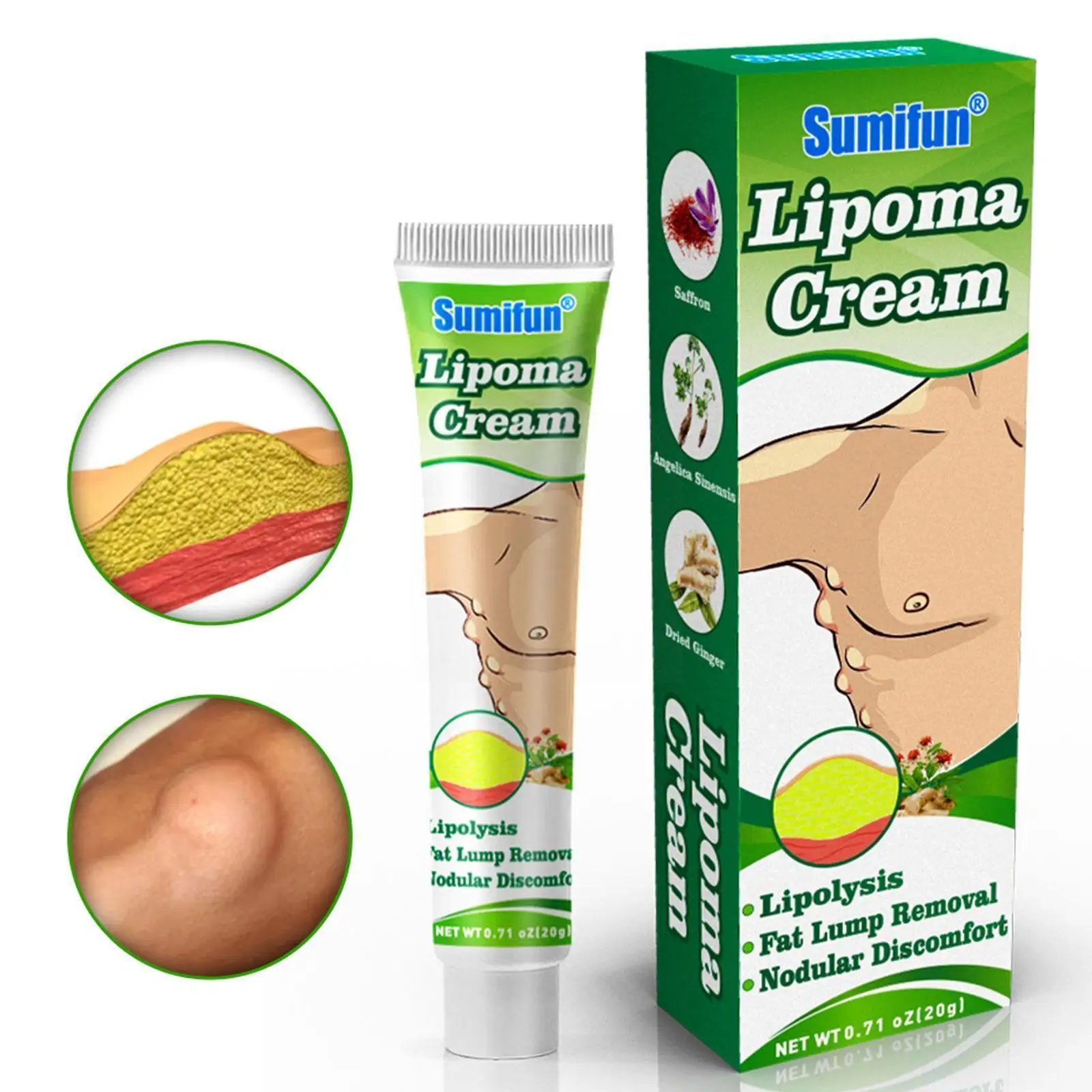 

20g Lipoma Care Cream Lipoma Removal Cream Treat Skin Cellulite Granule Fat Ointment Skin Cream Care Care Swelling V1Z9