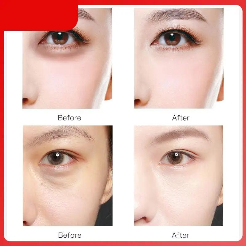 

60pcs Eye Mask Patch Remove Dark Circles And Eye Bags Diminish Eye Wrinkles Lasting Moisturizing Nourishing Eye Care