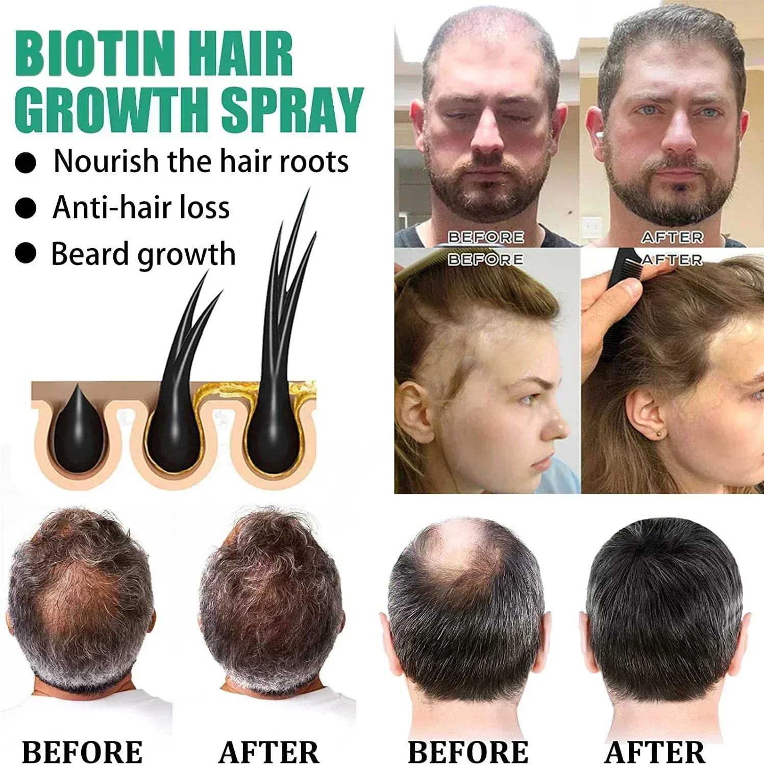 Hot sales Hair Growth Products Biotin Anti Loss Spray Scalp Treatment Fast Growing Care Essential Oils For Men Women
