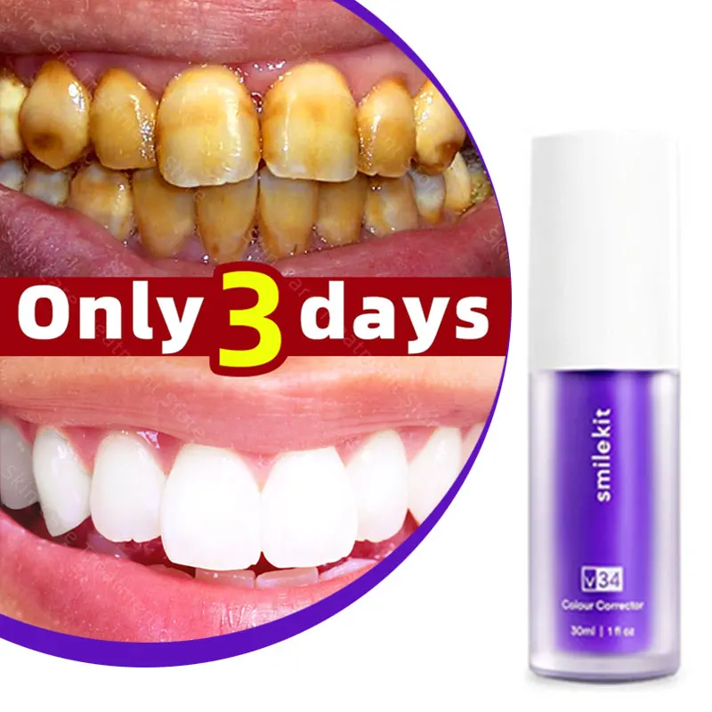 

30ml Tooth Cleansing Mousse Purple Bottled Press Toothpaste Refreshes Breath Whitens Teeth Stains Stains Removal Dental Care