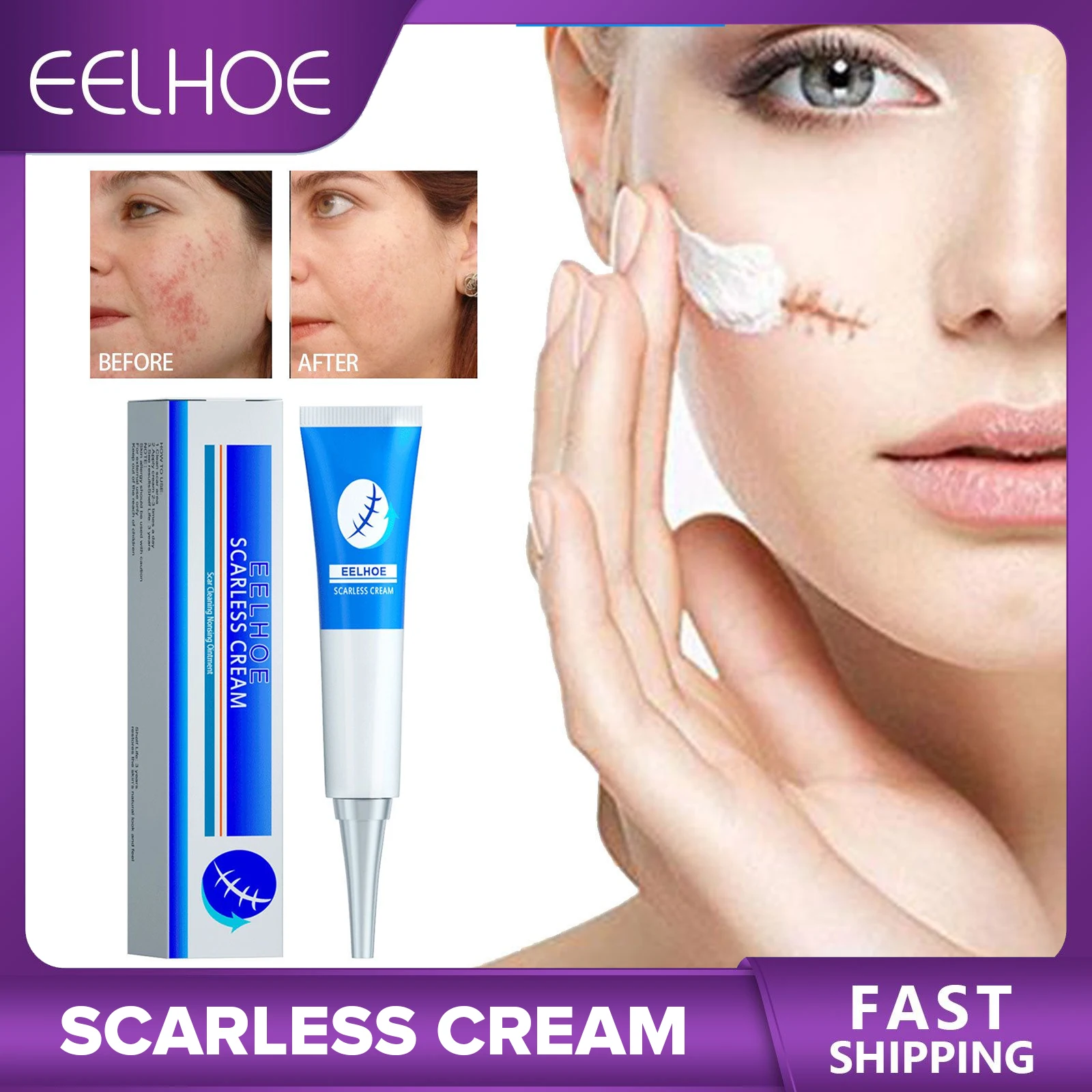 

Acne Scar Removal Cream Skin Repair Ointment Treatment Fade Stretch Marks Burn Surgical Scars Smooth Skin Care Cell Regeneration