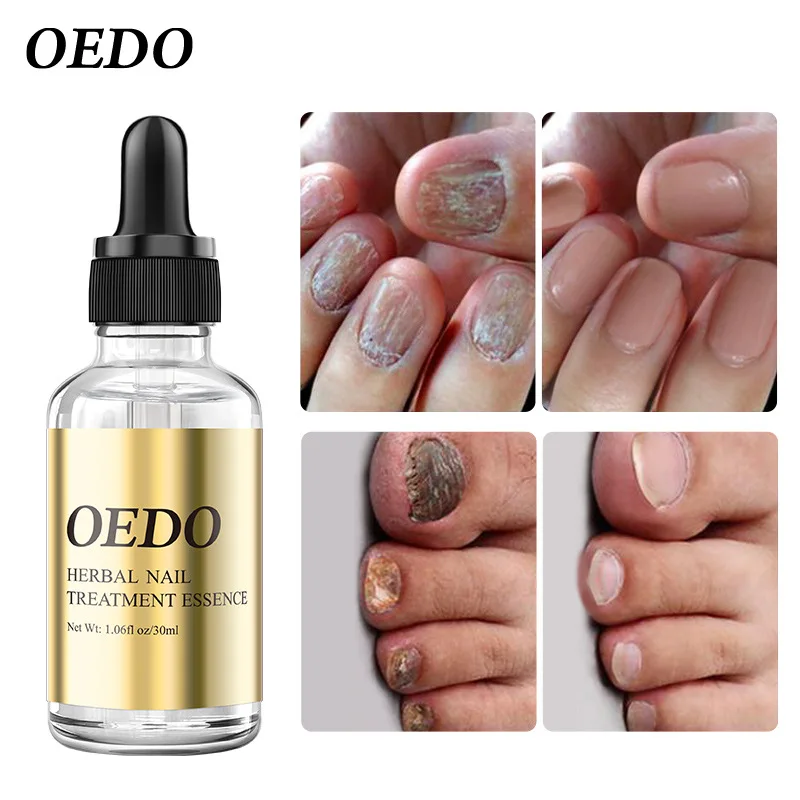 

Жидкое Восстанавливающее Средство для ногтей, 30 мл