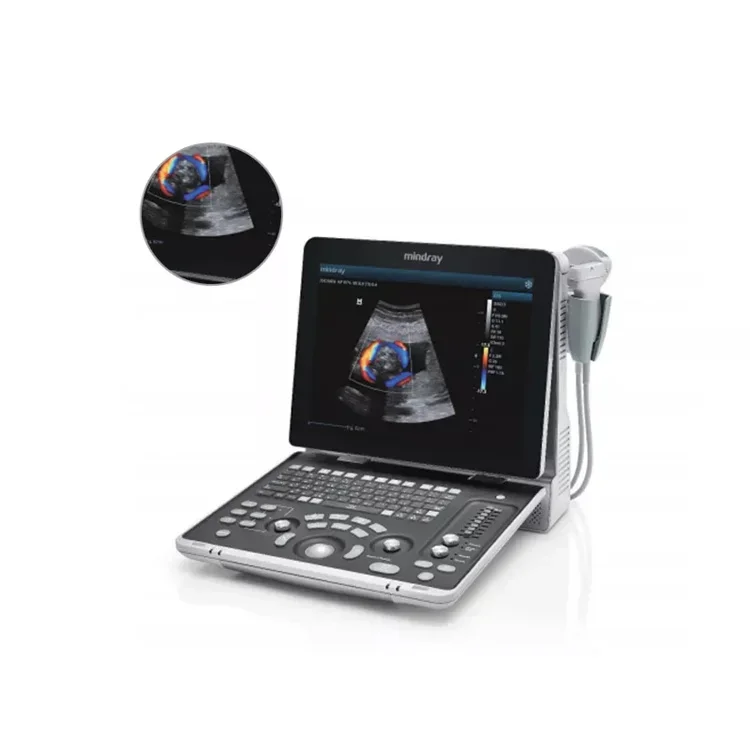 Медицинское ультразвуковое устройство Mindray портативный цветной допплер