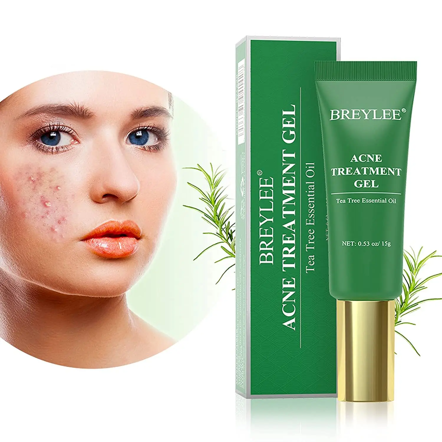 

New Tea Tree Acne Removal Gel Effective Treatment Face Pimple Marks Removal Gel Anti-Acne Acne Scar Spots Cream Skin Care 15g