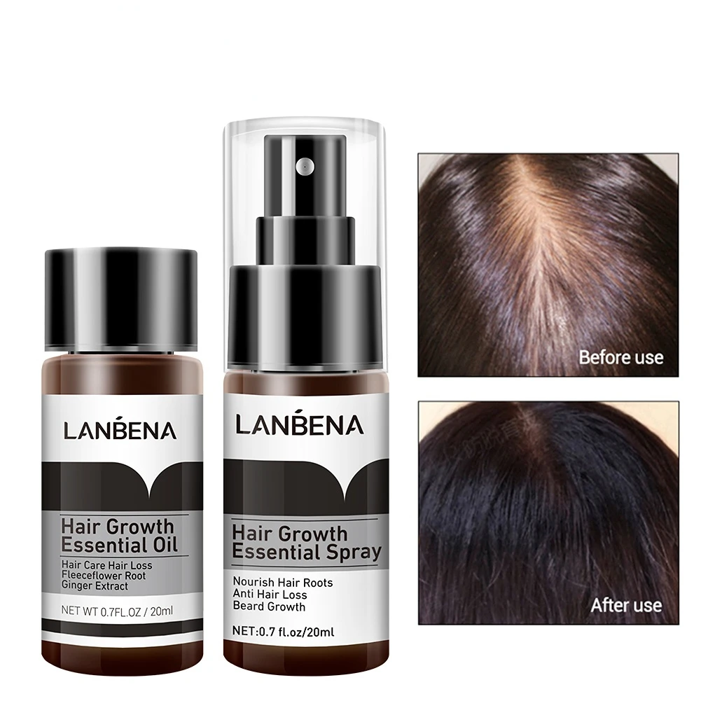 

Fast Hair Growth Essence Spray Preventing Nourish Roots Ginger Extract Treatment Hurt Hair Product Nourish Roots Care