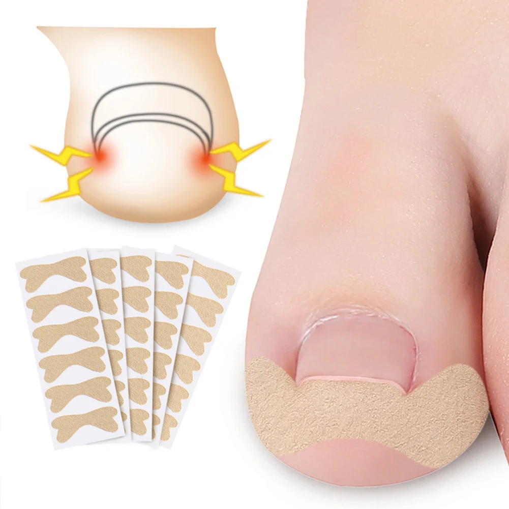 1 Sheet Professional Toenail Foot Corrector Stickers Elasticity Toe Nail Care Pedicure Tools Health Care Protects Toe Nail