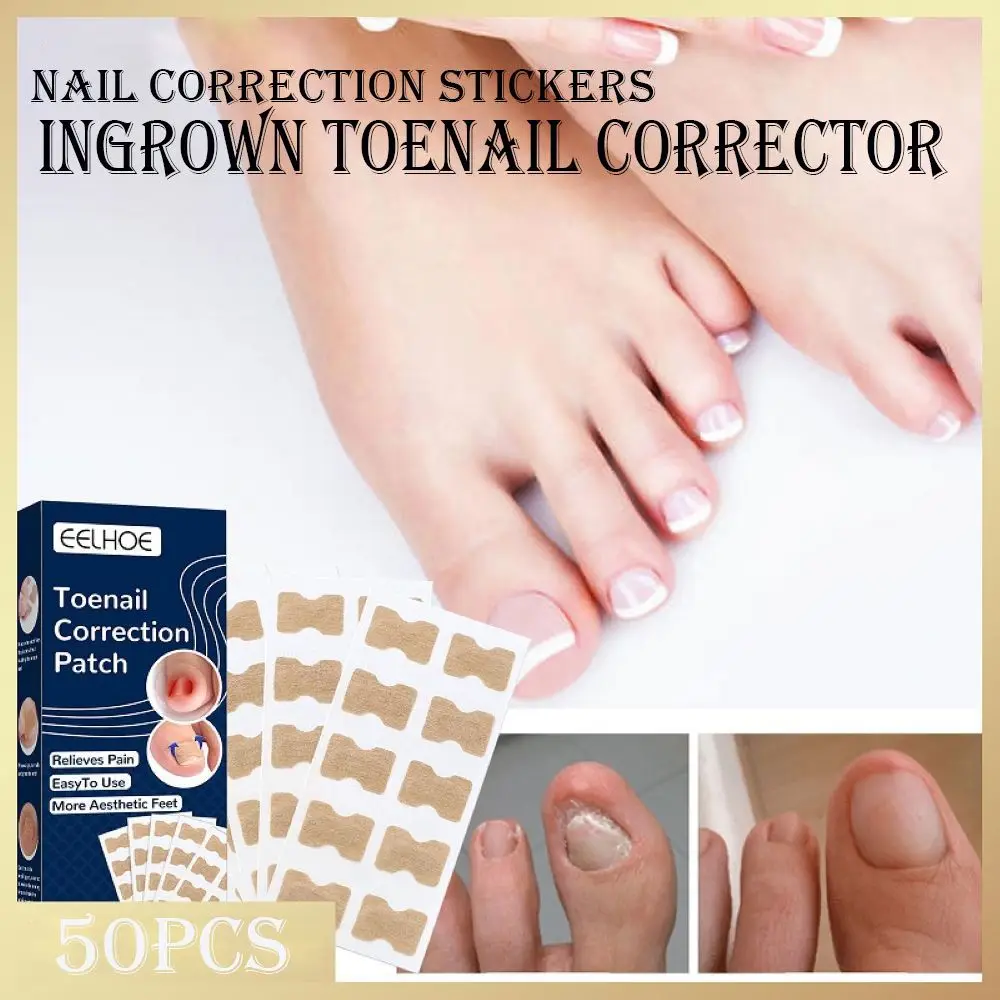 

Care Recover Paronychia Treatment Pedicure Tool Ingrown Toenail Nail Correction Stickers Waterproof Corrector Patches