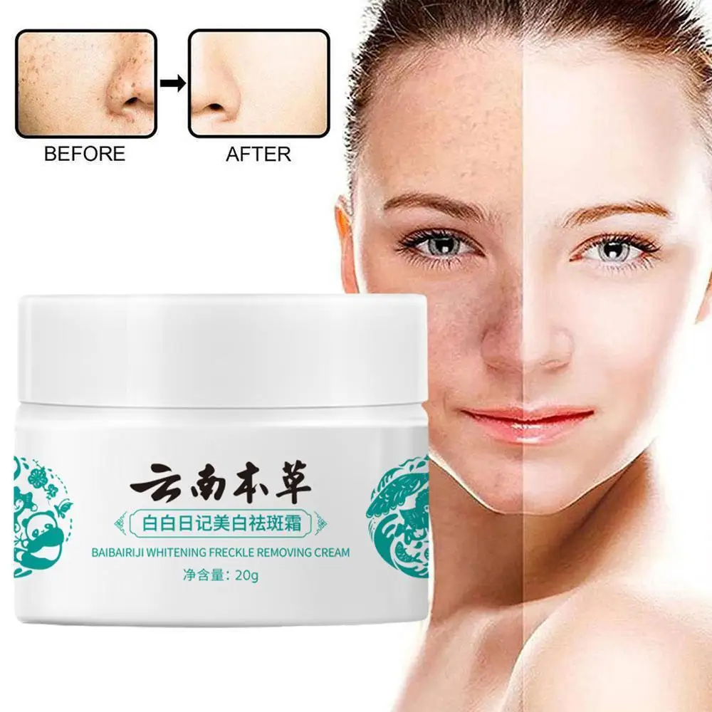 

Yunnan Herbal Whitening Freckle Cream Effective Remove Melasma Cream Remove Dark Spots Moisturize Brighten Skin Care