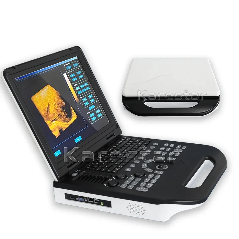 15-дюймовый ЖК-экран гинекология лучшее качество портативный 3D цветной Доплер