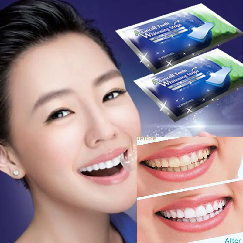 

2Pcs/1Pair Professional Oral Care Hygiene Teeth Whiten Tools Teeth Whitening Strips Gel Dental Bleaching Tooth Whitening Bleach