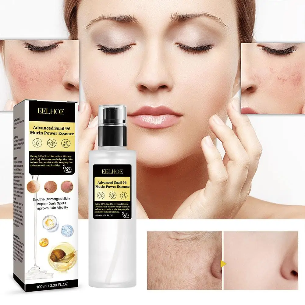 

Advanced Snail Anti Aging Serum Fade Outthe Fine Lines Treatment Care Wholesale Reparing Anti Products 100ml Acne Skin Wrin I7O7