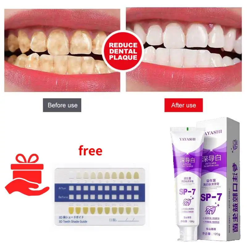 

Probiotic Toothpaste Stain Removing Whitening Toothpaste SP-4 Cavity Prevention Teeth Whitening Paste Toothpaste For Bad Breath