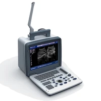 black and white ultrasound ecography scanner ce diagnostic system ultrasound