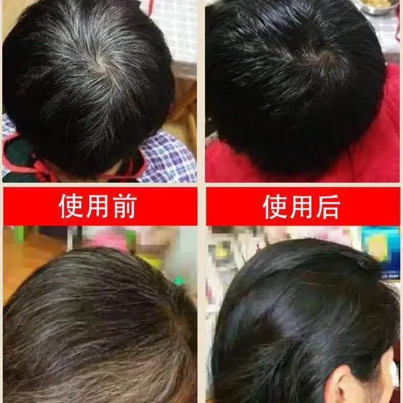 300 мл Polygonum Multiflorum Шампунь от белого до черного цвета травяной шампунь эффективное