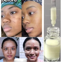 retinol original liquid facial essence whitening anti aging spot removal melanin facial skin care products acne treatment