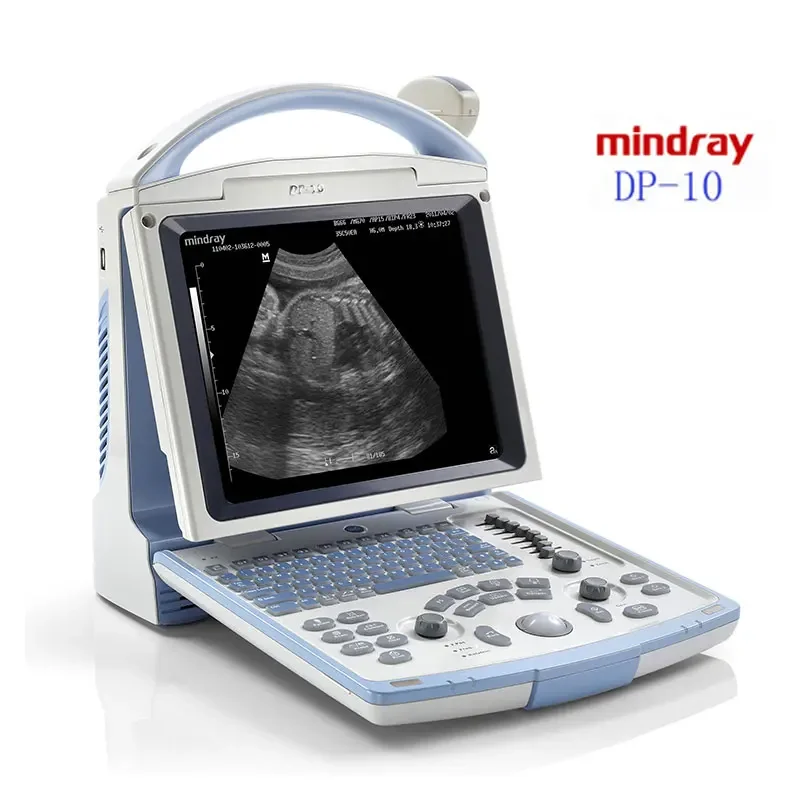 Портативный медицинский ультразвуковой аппарат Mindray Sonografo Portatil Ecografo Dp 10