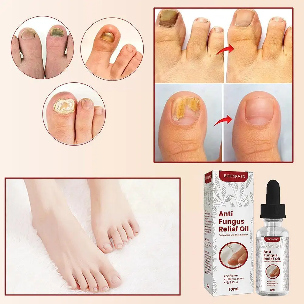 

10ML Anti Fungus Relief Oil Foot Repair Essence Toe Cream Treatment Nail Fungus Nail Anti Oil Gel Fungal Removal Infection X6X4