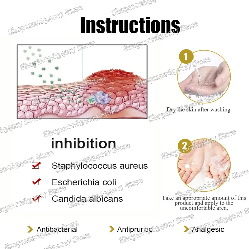 Псориаз Антибактериальный против зуда Дерматити Экзема Крапивница Алергия Кожа