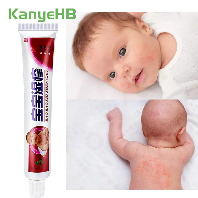 

1pcs Baby Eczema Treatment Cream Cure Psoriasis Baby Kids Skin Problem Anti-itching Herbal Essence Children Medical Plaster S011