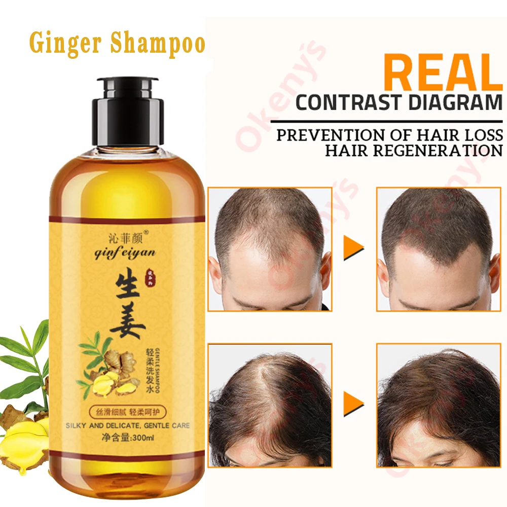 Genuine Professional Hair Ginger Shampoo 300ml, Hair Regrowth Dense Fast, Thicker, Hair Growth Shampoo Anti Hair Loss Product