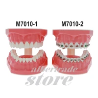 dental teach typodont demonstration teeth model with metal brackets wires ties tubes for patient study 11 m7010 1