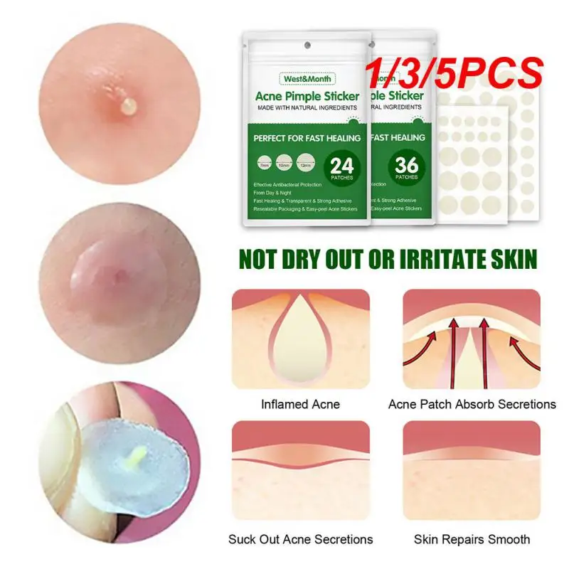 

1/3/5 шт., пластырь от прыщей и прыщей